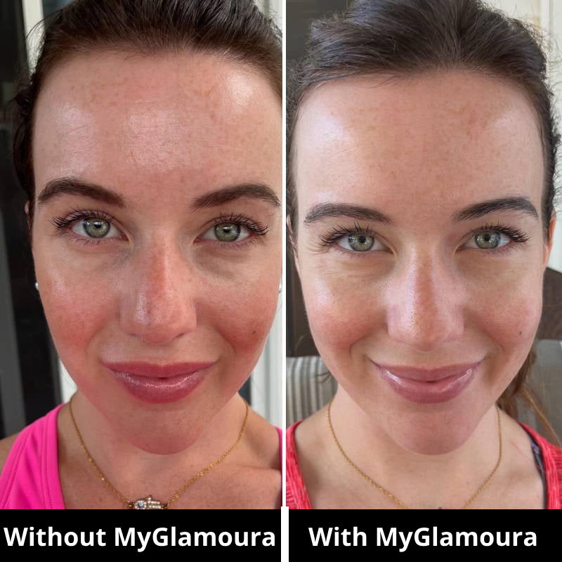 GLED Pro Light Therapy Mask